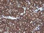 VHL Antibody in Immunohistochemistry (Paraffin) (IHC (P))