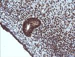 VHL Antibody in Immunohistochemistry (Paraffin) (IHC (P))