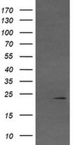 VHL Antibody in Western Blot (WB)