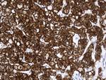 VIL1 Antibody in Immunohistochemistry (Paraffin) (IHC (P))