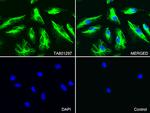 VIM Antibody in Immunocytochemistry (ICC/IF)