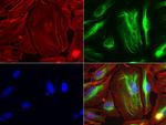 VIM Antibody in Immunocytochemistry (ICC/IF)