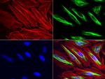 VIM Antibody in Immunocytochemistry (ICC/IF)