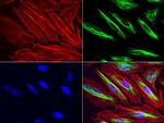 VIM Antibody in Immunocytochemistry (ICC/IF)