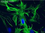 VIM Antibody in Immunocytochemistry (ICC/IF)