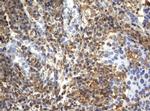 VIM Antibody in Immunohistochemistry (Paraffin) (IHC (P))