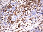 VIM Antibody in Immunohistochemistry (Paraffin) (IHC (P))