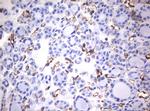 VIM Antibody in Immunohistochemistry (Paraffin) (IHC (P))