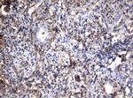 VIM Antibody in Immunohistochemistry (Paraffin) (IHC (P))