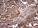 VIM Antibody in Immunohistochemistry (Paraffin) (IHC (P))