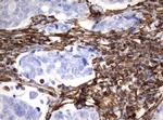 VIM Antibody in Immunohistochemistry (Paraffin) (IHC (P))