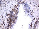 VIM Antibody in Immunohistochemistry (Paraffin) (IHC (P))