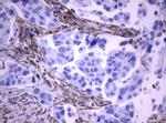 VIM Antibody in Immunohistochemistry (Paraffin) (IHC (P))