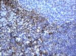 VIM Antibody in Immunohistochemistry (Paraffin) (IHC (P))