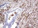 VIM Antibody in Immunohistochemistry (Paraffin) (IHC (P))