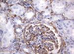 VIM Antibody in Immunohistochemistry (Paraffin) (IHC (P))