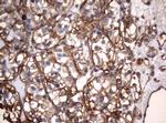 VIM Antibody in Immunohistochemistry (Paraffin) (IHC (P))