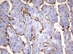 VIM Antibody in Immunohistochemistry (Paraffin) (IHC (P))