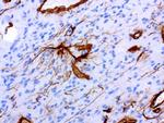 VIM Antibody in Immunohistochemistry (Paraffin) (IHC (P))