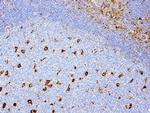 VIM Antibody in Immunohistochemistry (Paraffin) (IHC (P))