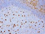 VIM Antibody in Immunohistochemistry (Paraffin) (IHC (P))