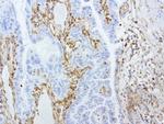 VIM Antibody in Immunohistochemistry (Paraffin) (IHC (P))