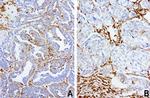 VIM Antibody in Immunohistochemistry (Paraffin) (IHC (P))