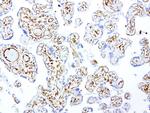 VIM Antibody in Immunohistochemistry (Paraffin) (IHC (P))