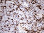 VIM Antibody in Immunohistochemistry (Paraffin) (IHC (P))