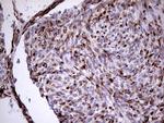 VIM Antibody in Immunohistochemistry (Paraffin) (IHC (P))