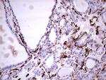 VIM Antibody in Immunohistochemistry (Paraffin) (IHC (P))