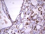 VIM Antibody in Immunohistochemistry (Paraffin) (IHC (P))