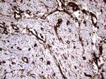 VIM Antibody in Immunohistochemistry (Paraffin) (IHC (P))