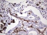 VIM Antibody in Immunohistochemistry (Paraffin) (IHC (P))