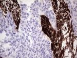 VIM Antibody in Immunohistochemistry (Paraffin) (IHC (P))