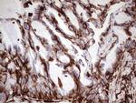 VIM Antibody in Immunohistochemistry (Paraffin) (IHC (P))