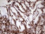 VIM Antibody in Immunohistochemistry (Paraffin) (IHC (P))