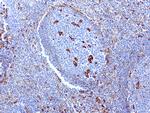 VIM Antibody in Immunohistochemistry (Paraffin) (IHC (P))