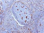 VIM Antibody in Immunohistochemistry (Paraffin) (IHC (P))