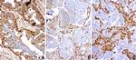 VIM Antibody in Immunohistochemistry (Paraffin) (IHC (P))