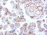 VIM Antibody in Immunohistochemistry (Paraffin) (IHC (P))