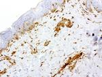 VIM Antibody in Immunohistochemistry (Paraffin) (IHC (P))