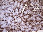 VIM Antibody in Immunohistochemistry (Paraffin) (IHC (P))