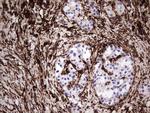 VIM Antibody in Immunohistochemistry (Paraffin) (IHC (P))