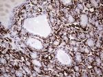 VIM Antibody in Immunohistochemistry (Paraffin) (IHC (P))