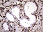 VIM Antibody in Immunohistochemistry (Paraffin) (IHC (P))