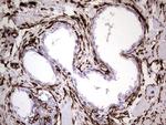 VIM Antibody in Immunohistochemistry (Paraffin) (IHC (P))