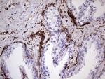 VIM Antibody in Immunohistochemistry (Paraffin) (IHC (P))