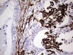 VIM Antibody in Immunohistochemistry (Paraffin) (IHC (P))