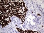 VIM Antibody in Immunohistochemistry (Paraffin) (IHC (P))